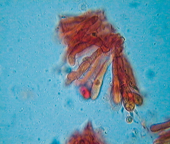 Tricholoma equestre vs. Tricholoma chrysophyllum